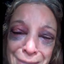 Mujer se niega a tener relaciones sexuales con un hombre y él la golpea con un ladrillo en la cara