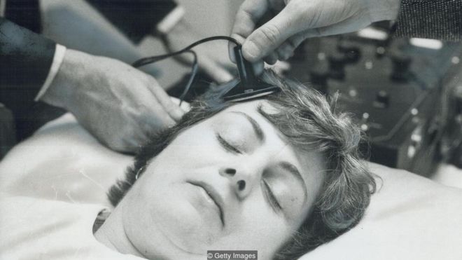 Por qué existe el estigma contra la terapia de electroshock pese a ser eficaz contra la depresión profunda (y 10 veces menos peligrosa que un parto) Por qué existe el estigma contra la terapia de electroshock pese a ser eficaz contra la depresión profunda (y 10 veces menos peligrosa que un parto)