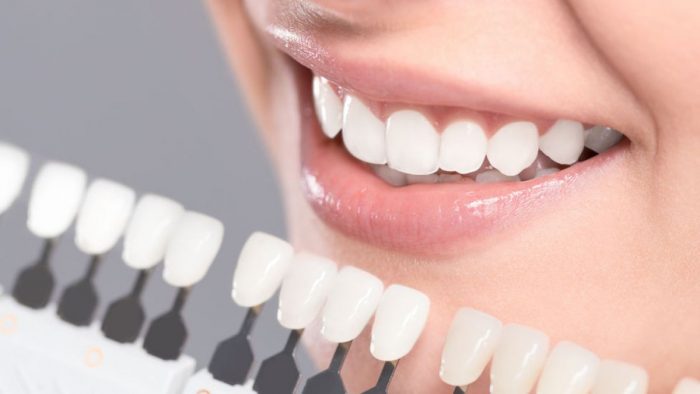 Los consejos para una “sonrisa divina” del Doctor Bill, el dentista de los famosos de Hollywood Los consejos para una “sonrisa divina” del Doctor Bill, el dentista de los famosos de Hollywood