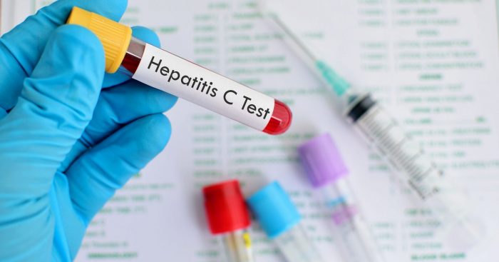 Hepatitis C: la enfermedad ignorada, oculta y olvidada Hepatitis C: la enfermedad ignorada, oculta y olvidada