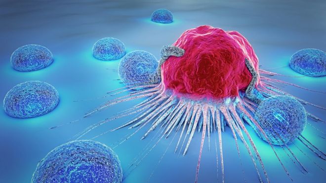 Por qué hay científicos que quieren dejar de llamar cáncer a algunos tumores Por qué hay científicos que quieren dejar de llamar cáncer a algunos tumores
