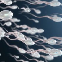 Qué es el varicocele, una de las causas más comunes de infertilidad masculina