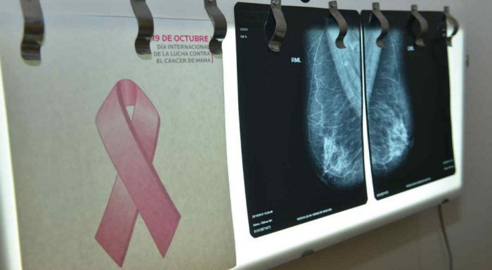 Solicitan al ministro de Salud incluir en el Auge el tratamiento avanzado para pacientes con cáncer de mama metastásico