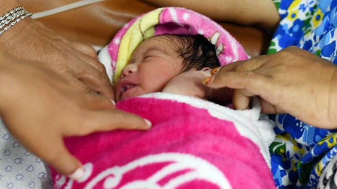 Por qué preocupa el aumento de cesáreas en todo el mundo (y en América Latina en particular)