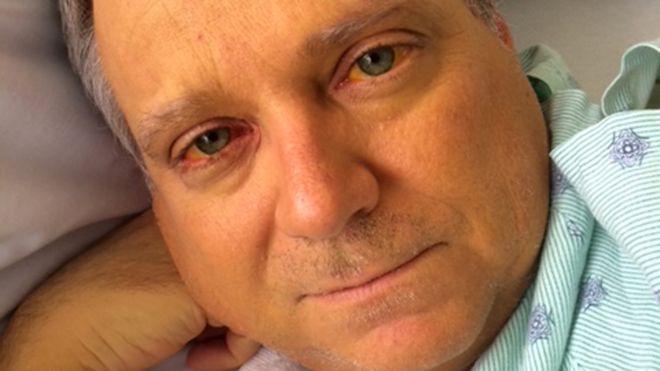 “El suplemento alimenticio que arruinó mi hígado”