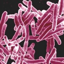 Científicos confirman que colonizadores europeos expandieron la tuberculosis
