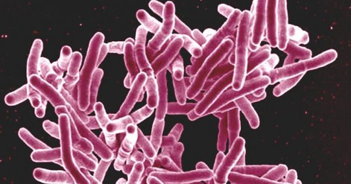 Científicos confirman que colonizadores europeos expandieron la tuberculosis