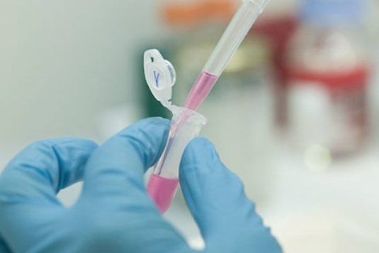 La crisis en salud de las infecciones de transmisión sexual en Chile La crisis en salud de las infecciones de transmisión sexual en Chile
