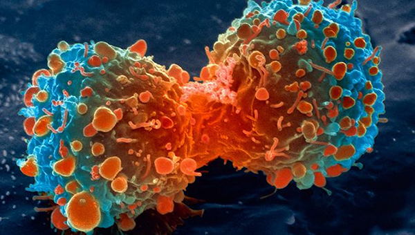 Nuevos hallazgos sobre la transmisión del cáncer abren posibilidad para desarrollar nuevas terapias Nuevos hallazgos sobre la transmisión del cáncer abren posibilidad para desarrollar nuevas terapias