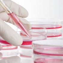 Estudio español logra eliminar el VIH en pacientes con trasplantes de células madre
