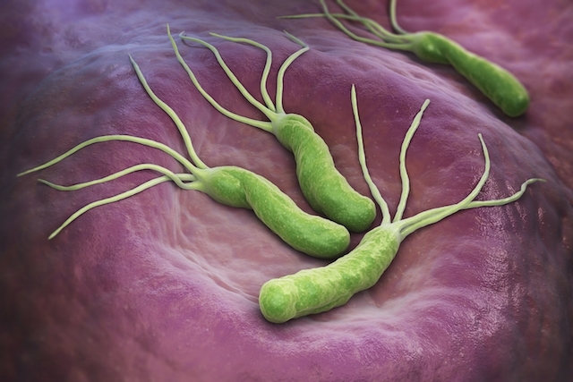 Gastroenterólogos advierten que un 70% de la población chilena porta la bacteria Helicobacter Pylori