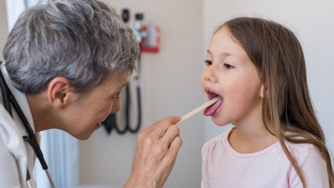 Cuándo se deben extraer las amígdalas y por qué tantos niños son operados sin necesidad Cuándo se deben extraer las amígdalas y por qué tantos niños son operados sin necesidad