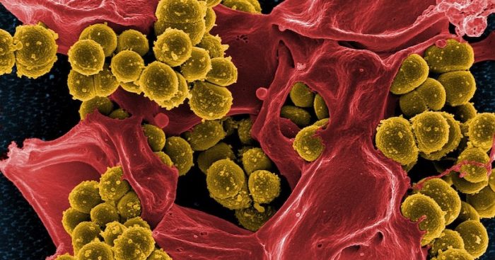 Científicos chilenos advierten que resistencia microbiana a los antibióticos retrasaría la medicina al Siglo XIX Científicos chilenos advierten que resistencia microbiana a los antibióticos retrasaría la medicina al Siglo XIX