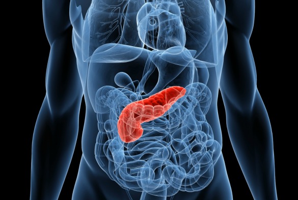 Día Mundial contra el Cáncer de Páncreas: tabaquismo y diabetes inciden en el aumento de casos Día Mundial contra el Cáncer de Páncreas: tabaquismo y diabetes inciden en el aumento de casos