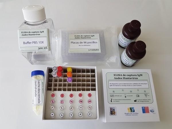 El innovador test rápido para detectar hantavirus El innovador test rápido para detectar hantavirus
