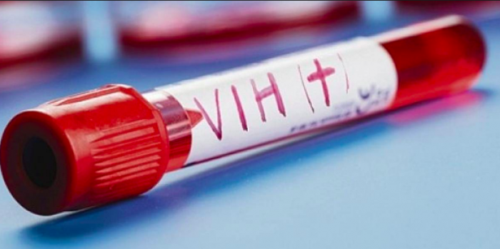 VIH en Chile: el fracaso de la visión biomédica