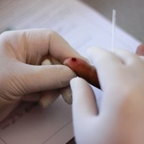 Minsal detalla las cifras de contagiados con VIH tras récord de casos nuevos en 2018