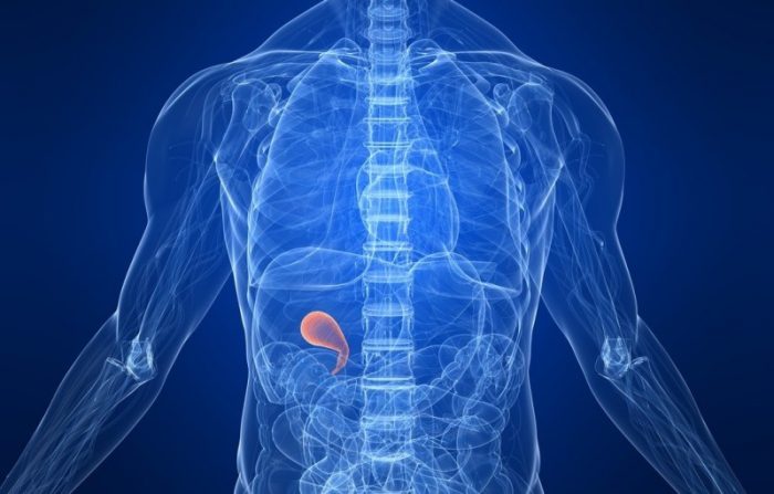 Estudian genes de riesgo que provocan cálculos en la vesícula y pueden derivar en cáncer Estudian genes de riesgo que provocan cálculos en la vesícula y pueden derivar en cáncer