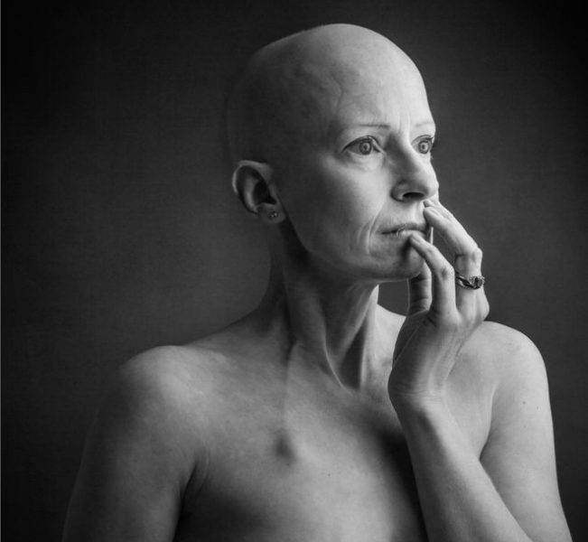 “Como muchas mujeres, no me revisé los senos”: la cirujana que operaba cáncer de mama y lo tuvo “Como muchas mujeres, no me revisé los senos”: la cirujana que operaba cáncer de mama y lo tuvo