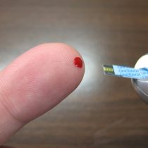 Pacientes con diabetes tienen un 21,8% de mortalidad por Covid-19