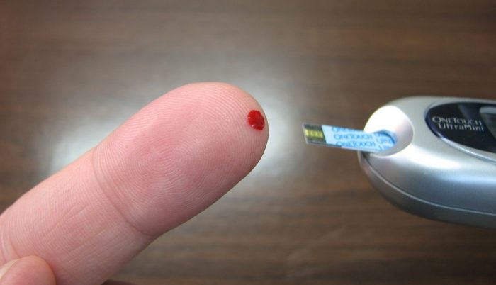 Pacientes con diabetes tienen un 21,8% de mortalidad por Covid-19 Pacientes con diabetes tienen un 21,8% de mortalidad por Covid-19