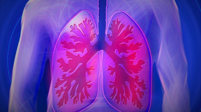 ¿Tiene tos y siente falta de aire y dificultad para respirar? Puede ser fibrosis pulmonar idiopática ¿Tiene tos y siente falta de aire y dificultad para respirar? Puede ser fibrosis pulmonar idiopática