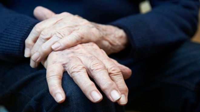 Parkinson: 4 síntomas que indican que tienes más probabilidades de padecer la enfermedad