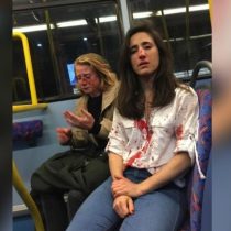 Ataque lesbofóbico: la brutal golpiza que recibió una pareja de lesbianas en Londres