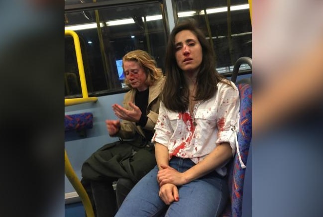 Ataque lesbofóbico: la brutal golpiza que recibió una pareja de lesbianas en Londres Ataque lesbofóbico: la brutal golpiza que recibió una pareja de lesbianas en Londres