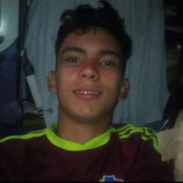 “Mi hijo se quiere matar”: el testimonio de la madre del joven al que dejó sin ojos la policía de Venezuela