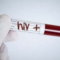 VIH/sida: cuáles son los países de América Latina con mayor aumento de nuevos contagios
