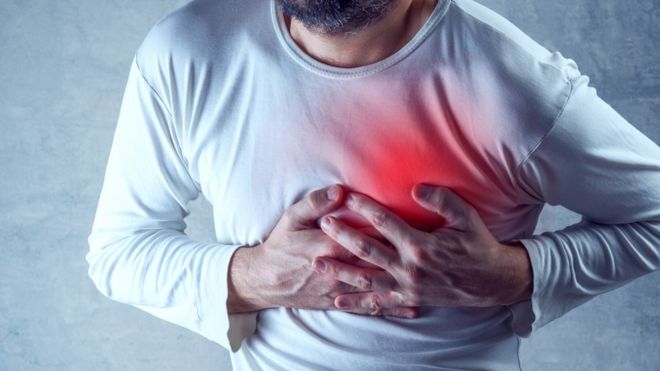 Ataques al corazón: por qué los humanos somos casi única especie que sufre esta condición