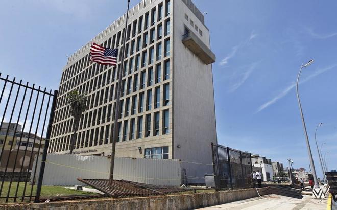 Estudio de EE.UU. concluye que “algo le pasó a los cerebros” de sus diplomáticos en Cuba Estudio de EE.UU. concluye que