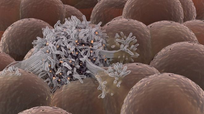 Cómo unas células sordas y manipuladoras originan el cáncer Cómo unas células sordas y manipuladoras originan el cáncer