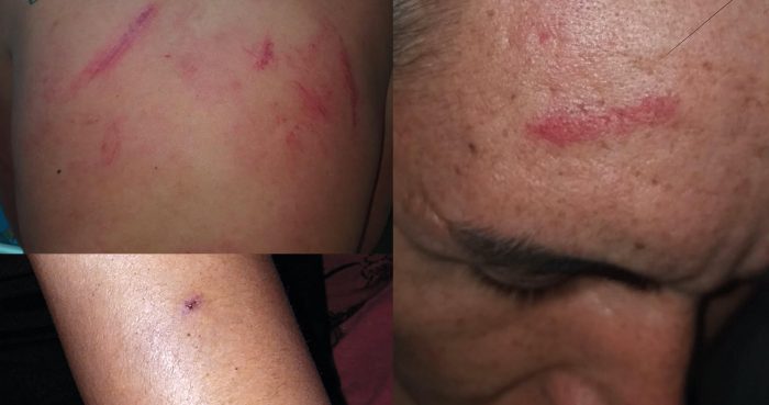 “¡Los vamos a matar maricas!”: atacan a pareja gay en Recoleta “¡Los vamos a matar maricas!”: atacan a pareja gay en Recoleta