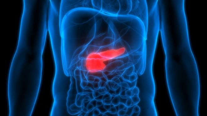 Cáncer de páncreas: la combinación de 2 fármacos que «mata de hambre» a las células cancerosas Cáncer de páncreas: la combinación de 2 fármacos que