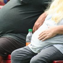 500 mil obesos mórbidos en Chile: médicos y pacientes piden mayor cobertura para cirugías bariátricas