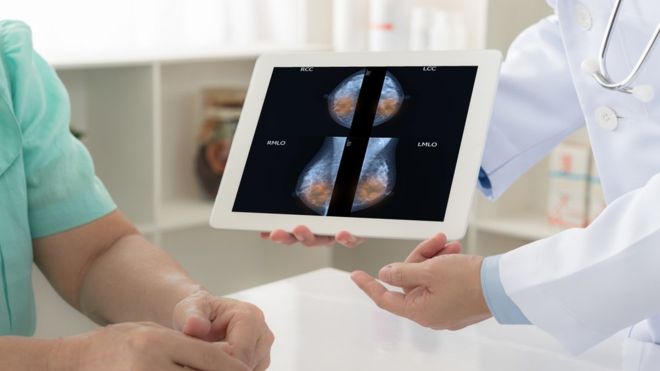 El tratamiento médico que podría eliminar el uso de la quimioterapia en los cánceres de mama agresivos El tratamiento médico que podría eliminar el uso de la quimioterapia en los cánceres de mama agresivos