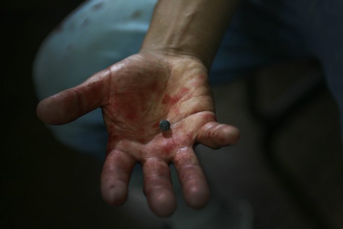 Víctimas de lesiones oculares durante el estallido social presentan más de 40 querellas criminales contra Piñera Víctimas de lesiones oculares durante el estallido social presentan más de 40 querellas criminales contra Piñera