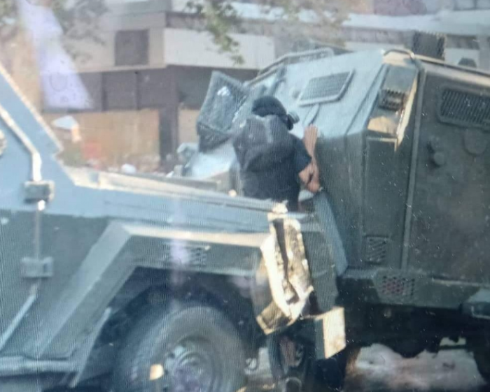 Joven atropellado por carro policial está fuera de riesgo vital pero sufrió fractura de cadera Joven atropellado por carro policial está fuera de riesgo vital pero sufrió fractura de cadera