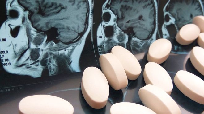 El inesperado y desconocido efecto del paracetamol y otros medicamentos comunes sobre nuestra personalidad El inesperado y desconocido efecto del paracetamol y otros medicamentos comunes sobre nuestra personalidad