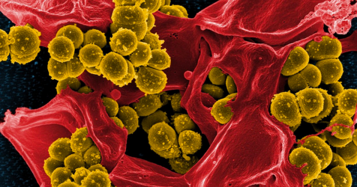 Científica chilena encuentra pista clave para combatir las infecciones bacterianas mortales Científica chilena encuentra pista clave para combatir las infecciones bacterianas mortales