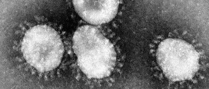 Los virus y el miedo: la importancia de las palabras y definiciones Los virus y el miedo: la importancia de las palabras y definiciones