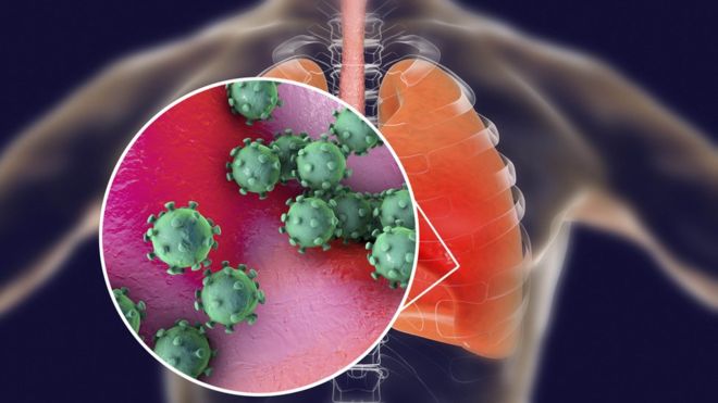 Coronavirus: ¿por qué no se han reportado casos en América Latina? Coronavirus: ¿por qué no se han reportado casos en América Latina?