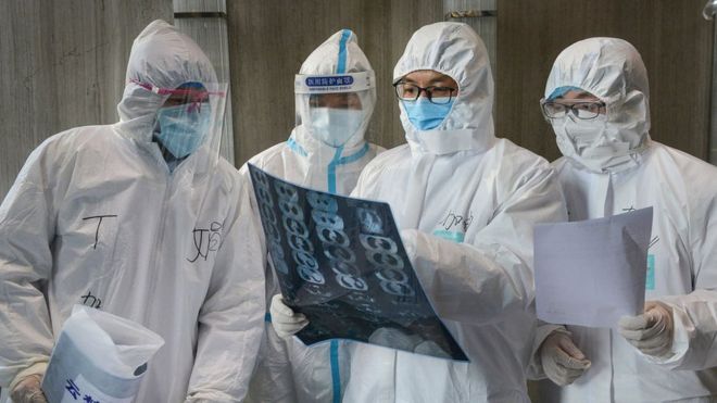 Coronavirus: qué hay detrás de los cambios en la forma de contar los casos confirmados en China Coronavirus: qué hay detrás de los cambios en la forma de contar los casos confirmados en China