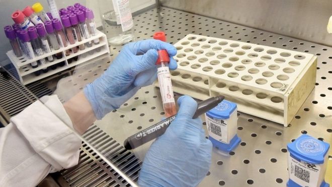 Coronavirus: qué se sabe del primer caso confirmado en América Latina Coronavirus: qué se sabe del primer caso confirmado en América Latina