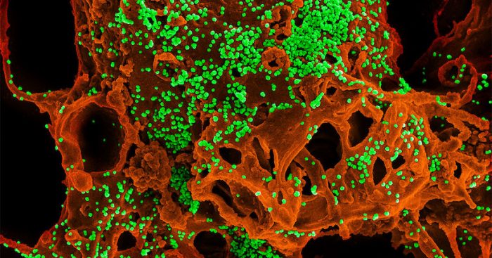 La ciencia se une y multiplica sus esfuerzos contra el nuevo coronavirus La ciencia se une y multiplica sus esfuerzos contra el nuevo coronavirus