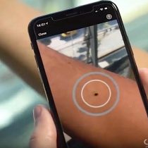 “Rendimiento pobre y variable”: advierten sobre el uso de apps que dicen detectar el cáncer de piel