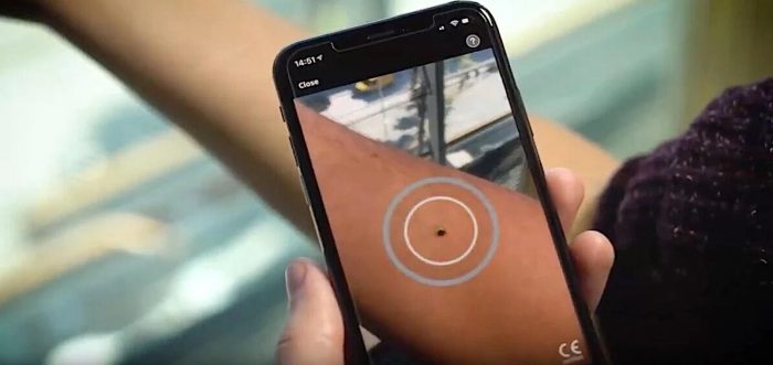 “Rendimiento pobre y variable”: advierten sobre el uso de apps que dicen detectar el cáncer de piel “Rendimiento pobre y variable”: advierten sobre el uso de apps que dicen detectar el cáncer de piel