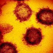 Covid-19: ¿Cuánto dura el proceso de incubación del coronavirus?